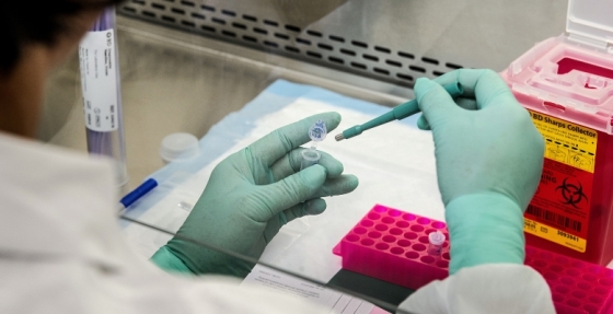 Enzalutamida aumenta tempo de vida global em homens com cancro da próstata não metastático resistente à castração