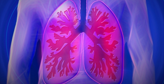 Divulgados os resultados de um estudo que avalia pembrolizumab em diferentes tipos de cancro do pulmão avançado