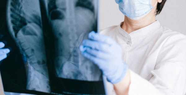 Assista aos melhores momentos do webinar "Squamous mNSCLC treatment"