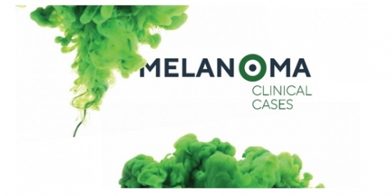 Está a chegar a reunião que coloca o doente com melanoma no centro da discussão