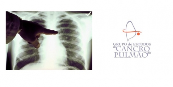 Grupo de Estudos do Cancro do Pulmão realiza 7.º Congresso em outubro