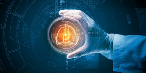 Pembrolizumab é o primeiro inibidor de PD1 em associação a revelar sobrevivência global no CPCNP