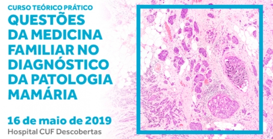 Questões da Medicina Familiar no diagnóstico da patologia mamária