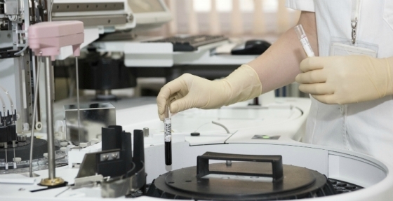 FDA autoriza atezolizumab em combinação com bevacizumab para doentes com a forma mais comum de cancro do fígado