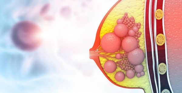 Estudo NATALEE demonstra benefício clínico de ribociclib em associação com terapêutica endócrina no cancro da mama precoce HR-positivo/HER2-negativo