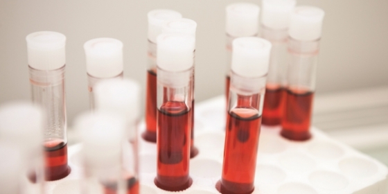 Novo teste ao sangue pode identificar oito tipos de cancro