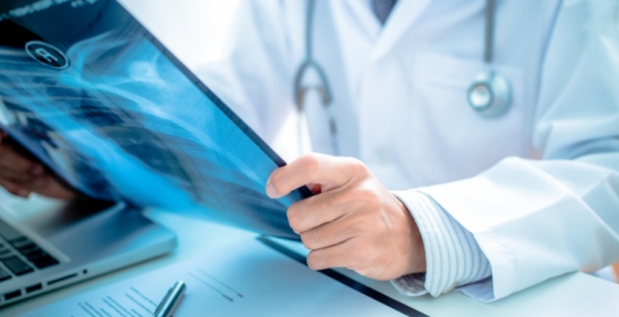 Imunoterapia no cancro do pulmão: Experiência clínica num centro que diagnostica 700 a 800 novos casos por ano