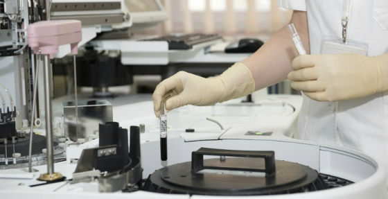 Investigadores portugueses descobrem novo mecanismo na forma como as células cancerígenas se alimentam de glicose