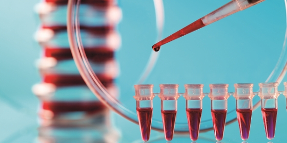 Biocartis lança testes de biópsia líquida para deteção de mutações RAS em doentes com mCRC