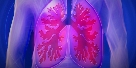 Pembrolizumab demonstra benefício contínuo de sobrevivência global no CPCNP metastático com elevada expressão de PD-L1
