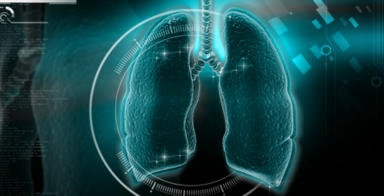 Comissão Europeia aprova associação terapêutica com atezolizumab em 1.ª linha para o tratamento de cancro do pulmão de pequenas células