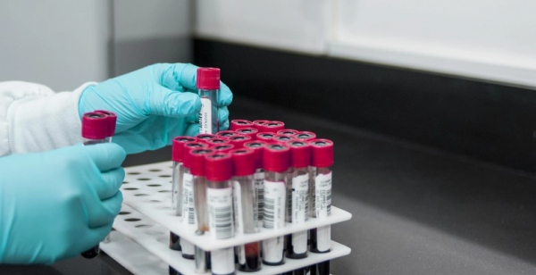 Estudo indica que cancro da mama pode ser detetado mais cedo com teste de sangue