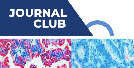 1.ª Edição do Journal Club do Grupo de Trabalho da Prevenção – SPO decorre online